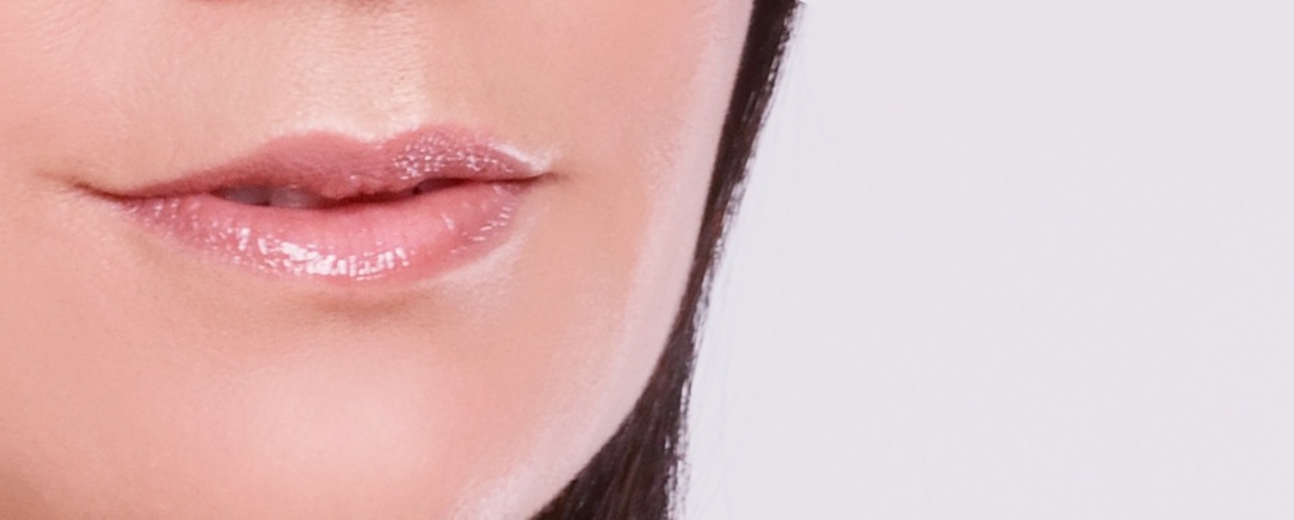 Upper lip lines