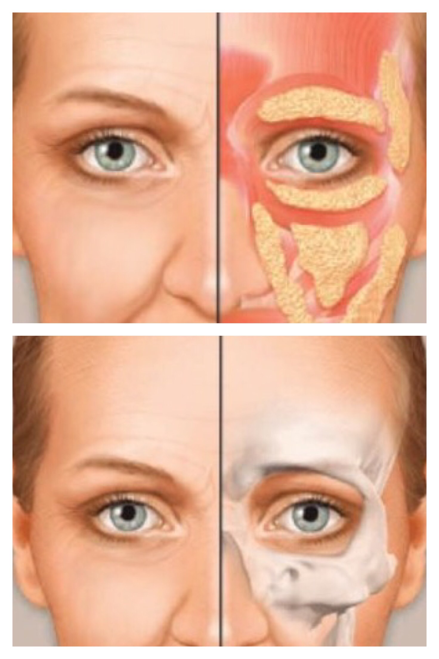 Under Eye Hollows/ Dark Circles/ Bags - Jeunesse MedSpa®